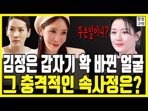 배우 김정은 갑자기 변해버린 얼굴! 그 충격적인 속사정은?