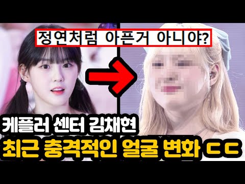 케플러 김채현 최근 충격적인 얼굴변화 ㄷㄷ