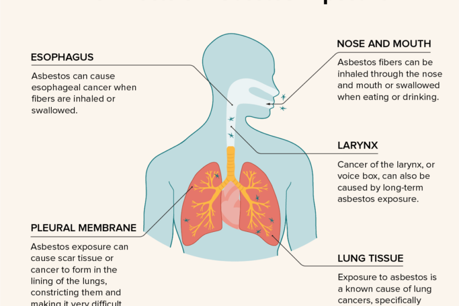 What'S The Link Between Asbestos And Lung Cancer?