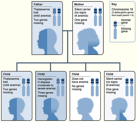 Alpha-Thalassemia - Wikipedia