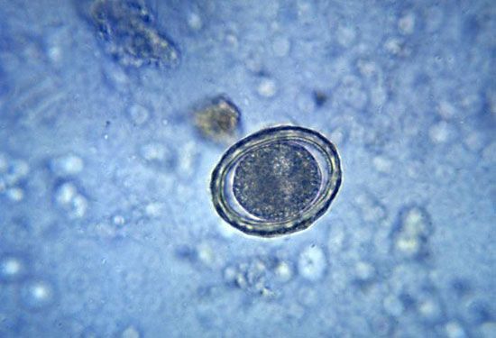 Ascariasis | Intestinal Worm, Infection, Treatment | Britannica