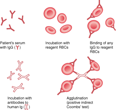 Overview Of Hemolytic Anemia - Hematology And Oncology - Msd Manual  Professional Edition