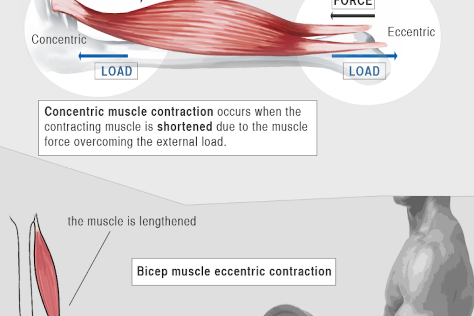 Health Check: Why Do My Muscles Ache The Day After Exercise?