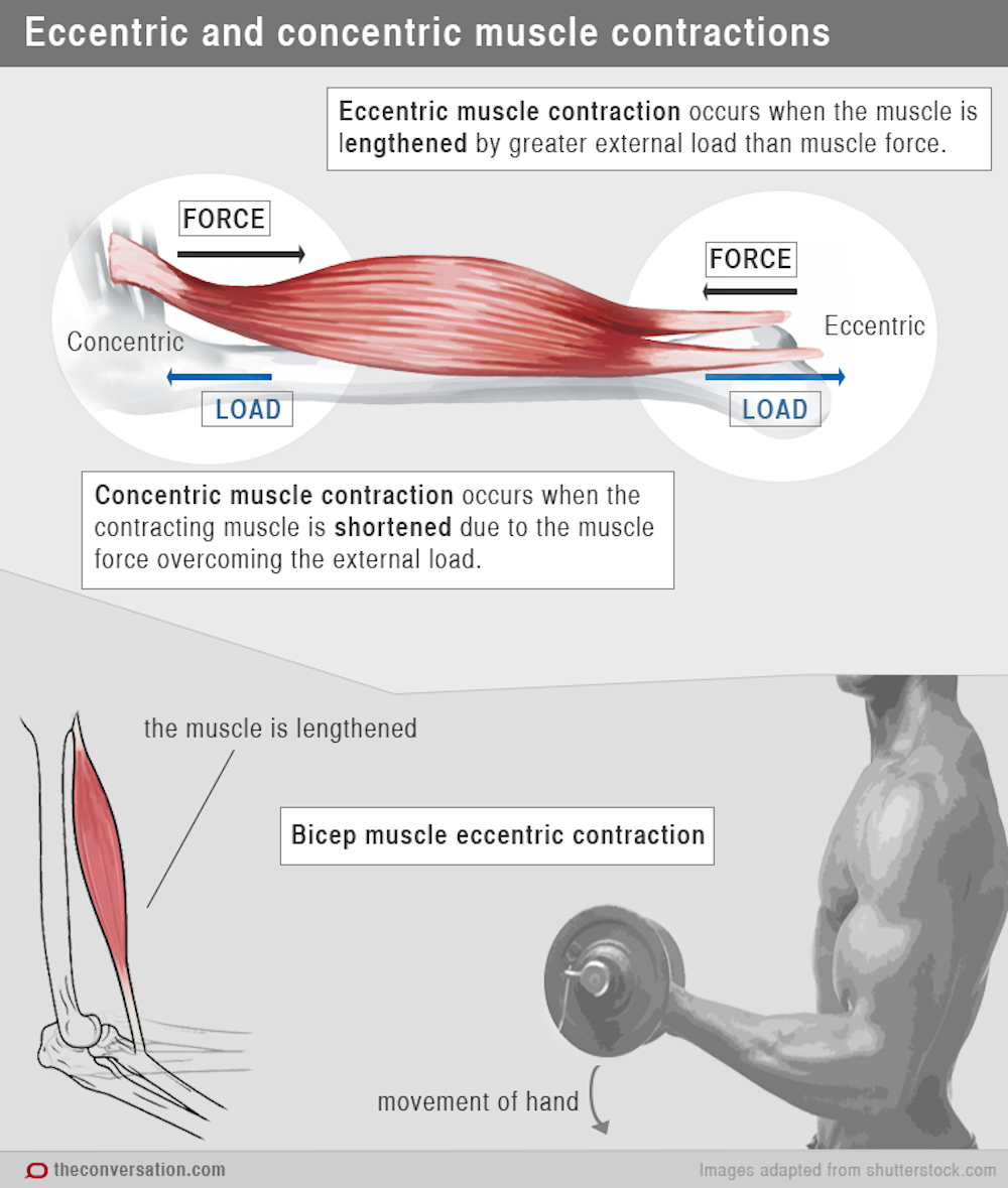 Health Check: Why Do My Muscles Ache The Day After Exercise?