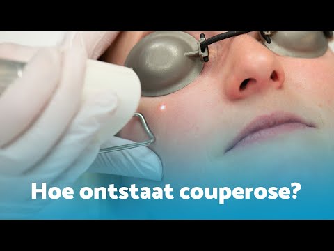 Hoe ontstaat couperose?