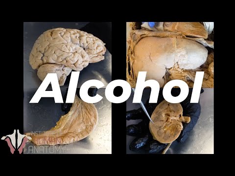 What Alcohol Does to Your Body