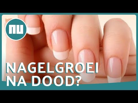 Groeien nagels en haren verder na de dood? | NU.nl