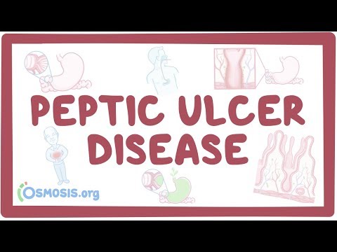 Peptic ulcer disease - causes, symptoms, diagnosis, treatment, pathology