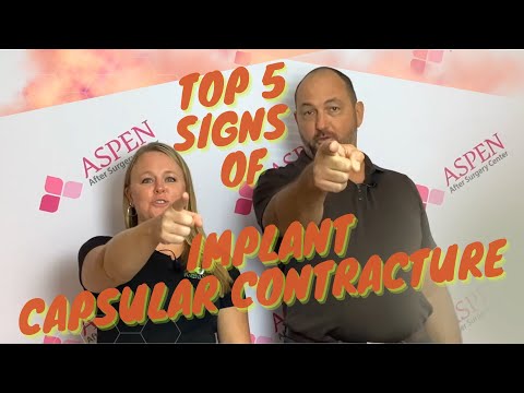 TOP 5 SIGNS OF IMPLANT CAPSULAR CONTRACTURE