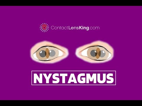 Nystagmus Eyes Explained | Involuntary Repetitive Eye Movement