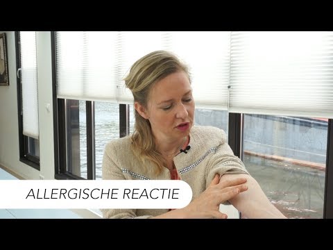 Allergieën, hoe zit dat nou? | Tips van Drs. Leenarts Dermatoloog