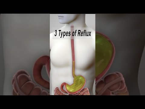 3 Types of Reflux (GERD, LPR, non-acidic LPR) #shorts @fauquierent